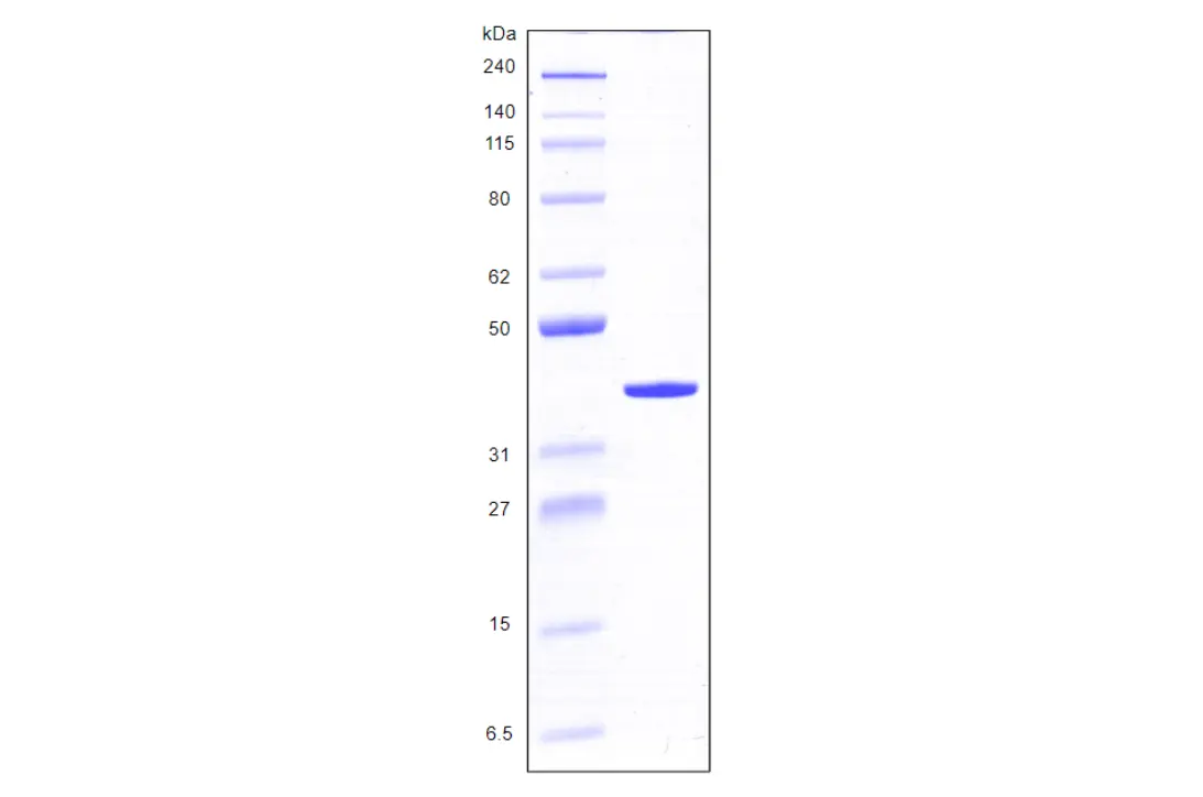 [MC03-050] Recombinant Human Galectin 8, variant 1, His Tag (317 a.a.) -50 ug